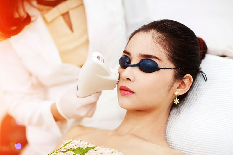 Laser renovation