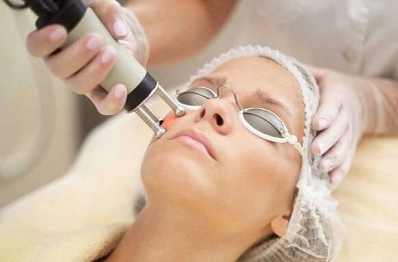 Thermal exposure to the epidermis